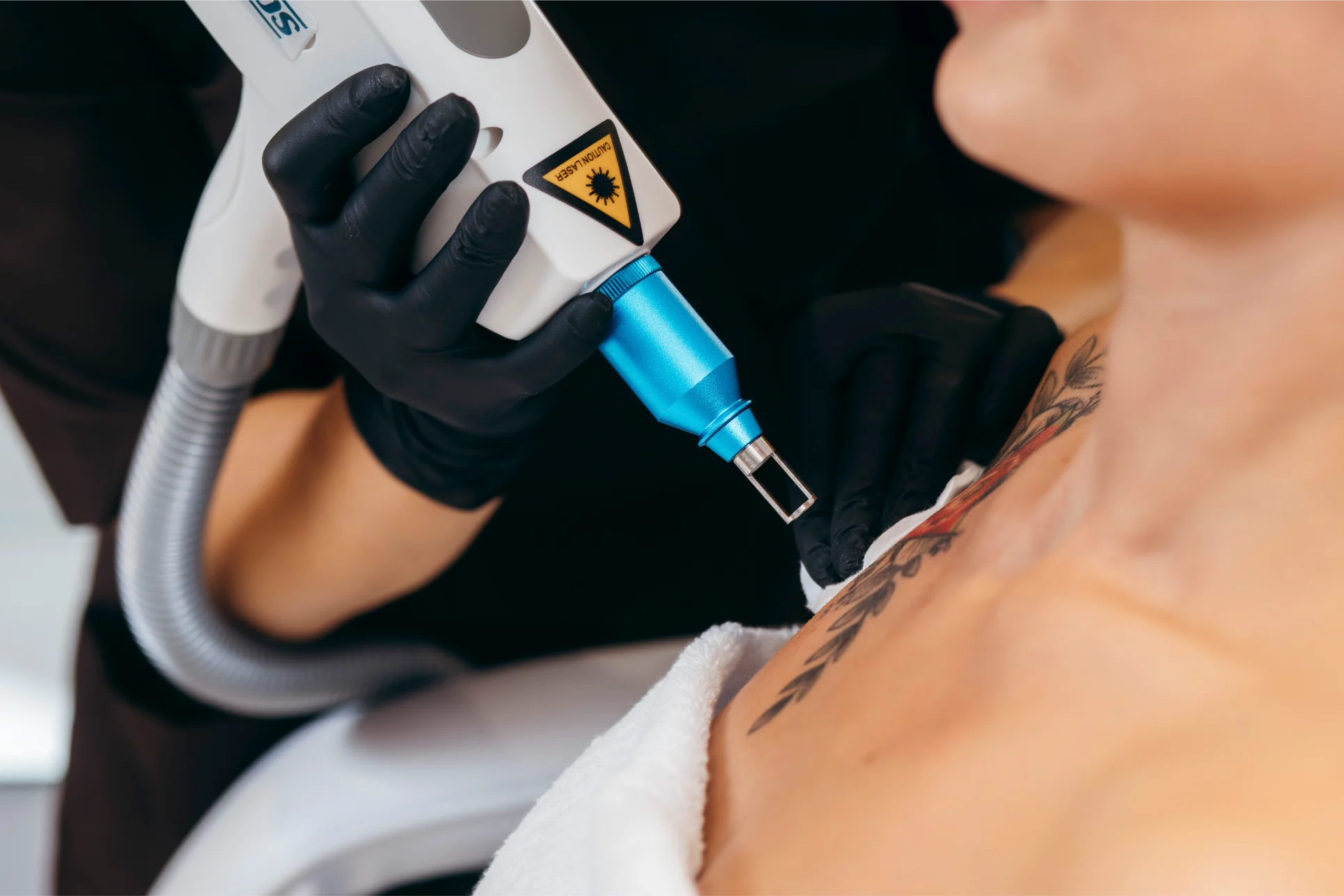 Nashville laser skin treatment consultation and personalized care plan