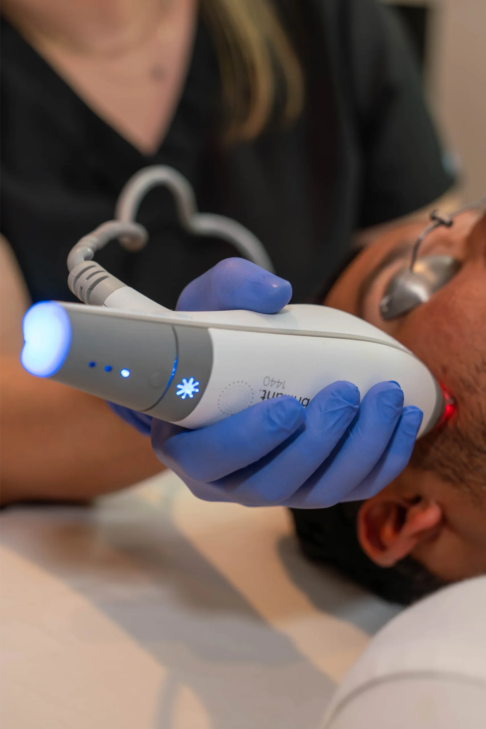 Blue laser device used to treat acne scars and sun damage at Gold Skin Care Center Nashville