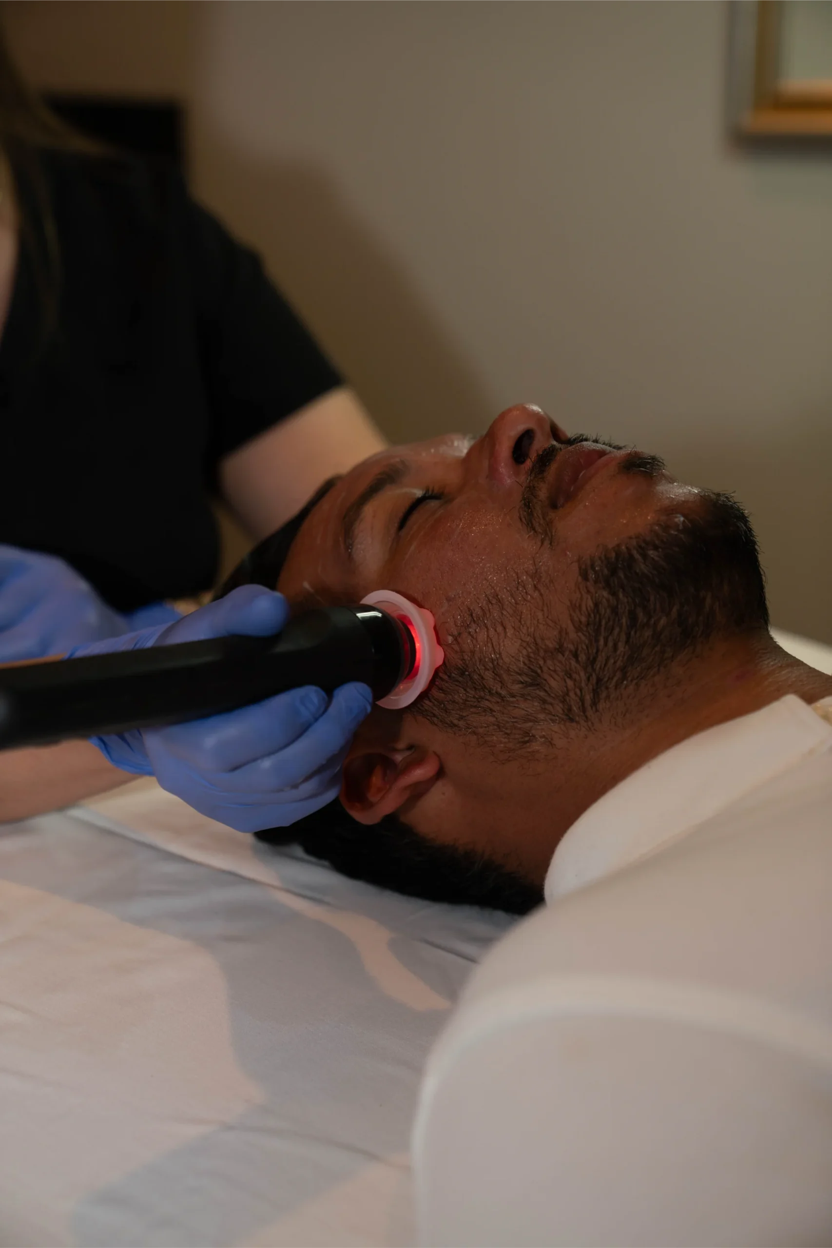 Dermatologist performing ablative laser deep resurfacing treatment on patient in Nashville